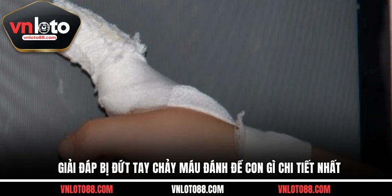 Giải đáp bị đứt tay chảy máu đánh đề con gì chi tiết nhất